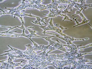 A novel viral gene therapy approach against prostate cancer via a stealth delivery technique called as UTMD (Ultrasound-Targeted Microbubble Destruction). It utilizes minute, gas filled bubbles to allow site-and target-specific release of cytotoxic payload through ultrasound.