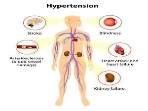 Damage From High Blood Pressure