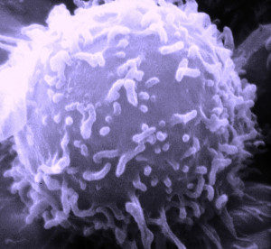 SEM_Lymphocyte