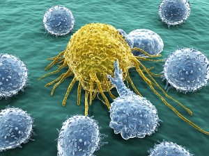Cancer cell attacked by lymphocytes